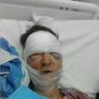 Viorica Bucătaru a fost transportată de urgenţă la spitalul din Fălticeni, de unde a fost transferată la o secţie specializată a unui spital din municipiul Iaşi