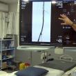 Crețeanu explică cum se desfundă vasele blocate în cazul arteritei