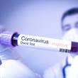 Coronavirus sursa jurnalulolteniei.ro