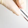 Test coronavirus